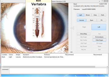 Medyczny 12.0MP USB Iris Scope Megapixel Digital Camera Eye Iris Analyzer