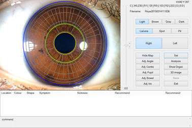 Przenośny skaner ręczny Eye Iris Eye Scan dla Health Detect