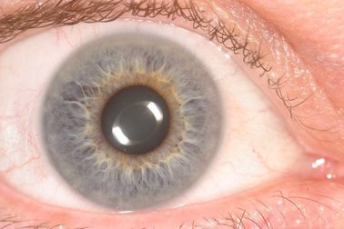 Przenośny skaner ręczny Eye Iris Eye Scan dla Health Detect