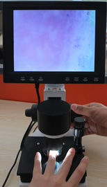 Sprzęt mikrokrążenia Color Nailfold Mikroskop kapilarny 380000 pikseli z CE