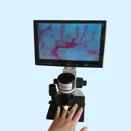 Wyświetlacz LCD Kolor mikrokrążenia Maszyna testowa Szpital Kliniczny