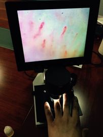CE zatwierdzony mikroskop mikrokyrkulacyjny OEM ekran LCD do sprawdzania paznokci