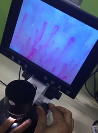 Mikroskop mikrokrążenia następnej generacji, mikroskop naczyniowy na krew do opieki zdrowotnej