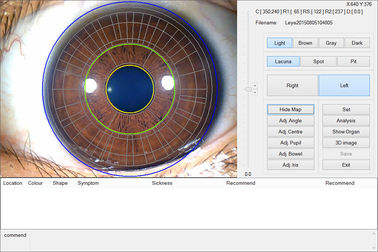 12.0MP Digital Iriscope Iridology Camera Eye Testing Machine CE/DHL Approval