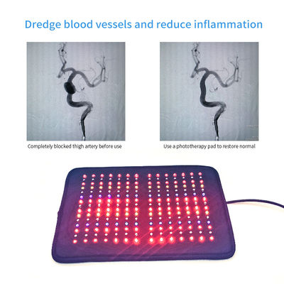 Podkładki do terapii światłem podczerwonym o częstotliwości 20000 Hz do mikrokrążenia krwi